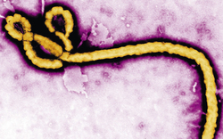 Entwarnung! Kein Ebola in Oberösterreich