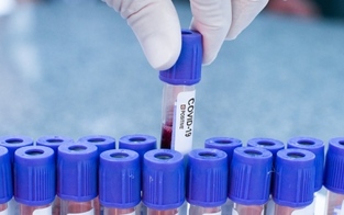 Über 2 Millionen PCR-Tests bei "NÖ gurgelt" ausgewertet