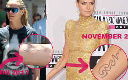 Heidi Klum lässt Seal-Tattoo entfernen